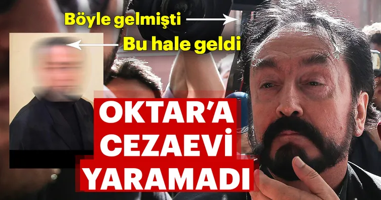 Adnan Oktar’a cezaevi yaramadı