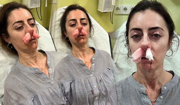 SON DAKİKA... Eşinin sevgilisi sandığı kadını öldüresiye darp etti: Ağzımdan burnumdan kan gelmeye başladı…