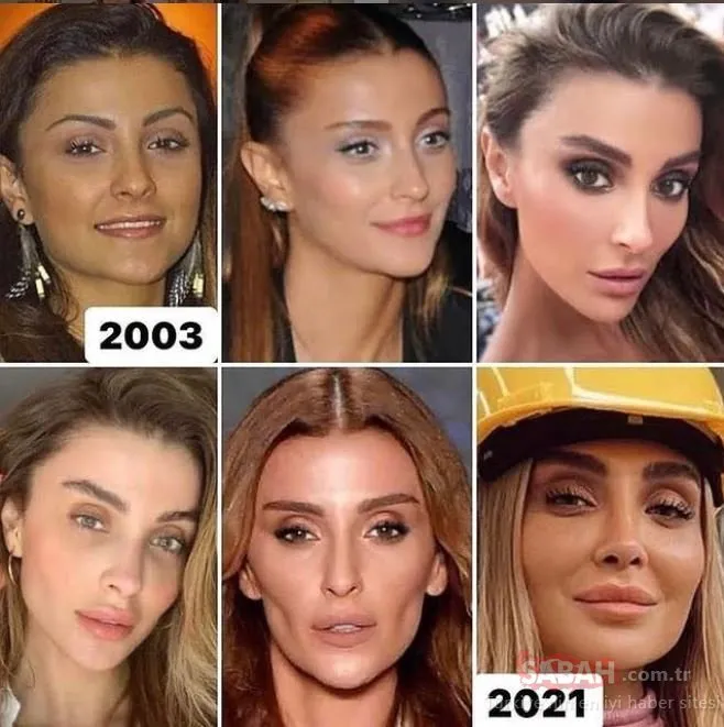Özge Ulusoy �Estetiğim yok� dedi eski hali alay konusu oldu! Özge