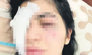 Yüzümden silahla vurulduğumu sandım