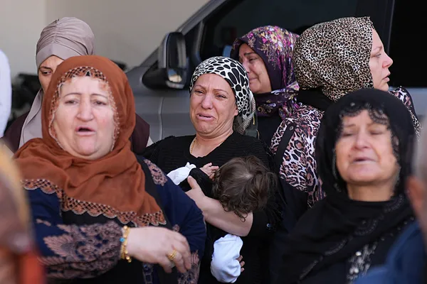 izmirde-23-yasindaki-hatice-burun-estetigi-ameliyati-sonrasi-can-verdi-aileden-ihmal-iddiasi-1777546518785.jpg