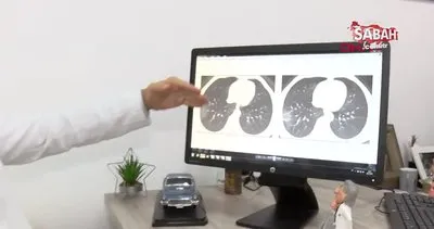 Koronavirüs korkusuyla gereksiz tomografi çektirenlere meme kanseri uyarısı | Video