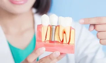 Ağzınız implanta uygun mu?