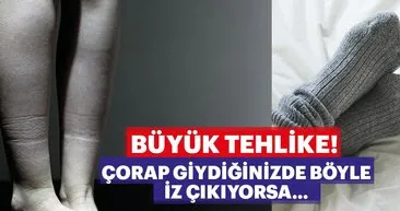 İşte kalbinizin düzgün çalışmadığını gösteren 8 işaret