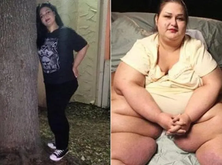 ’Yeğenini ezerek öldürdü’ haberi hayatını değiştirdi! Tam 378 kilo verdi: Dünyanın en kilolu kadını bambaşka biri oldu