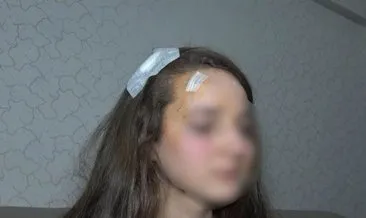 Bursa’da genç kıza muştayla saldırdı! Savunması şaşırttı: Bilerek olmadı!