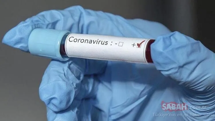 SON DAKİKA: Corona virüs tedavisinde flaş gelişme! O ilaçlar hastaları hayata bağlıyor...