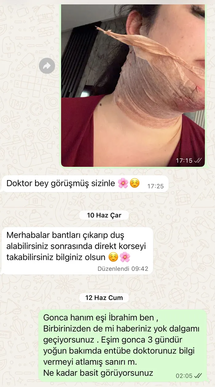 estetik-ameliyati-sonrasi-yogun-bakimda-2-gun-tedavi-gordu-doktor-hakkinda-sikayetci-oldu-1788597946483.jpg