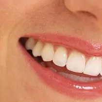 apseli dise ne iyi gelir apseli dis