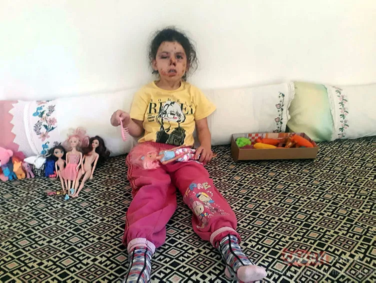 İzmir’de korkunç olay! 5 yaşındaki Neriman Bulut'u bu hale getirdiler!