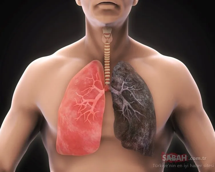 Sigara korona virüsün ciğerlere yerleşmesini kolaylaştırıyor! İşte ciğerleri temizleyen mucizevi besinler