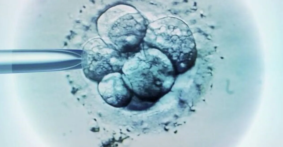 Tup Bebek Skandalinda Mahkeme Kararini Verdi Son Dakika Haberler