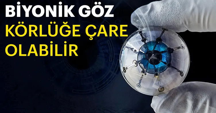 ‘Biyonik göz’ körlüğe çare olabilir