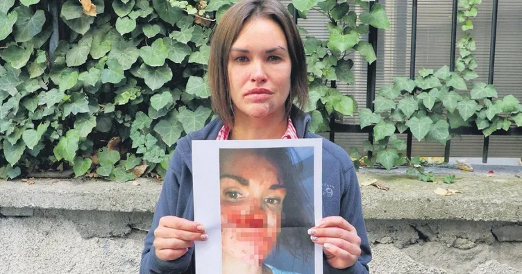 Güzellik uzmanına koca şiddeti