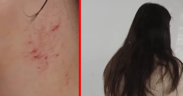 Ankara’da dehşet gecesi: Tarlaya götürüp boğazımı sıktılar tecavüz ettiler! O anları anlattı...