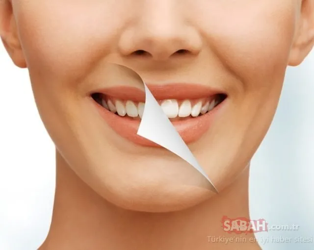 Evde diş beyazlatma yöntemleri neler? İşte o mucize teknikler…
