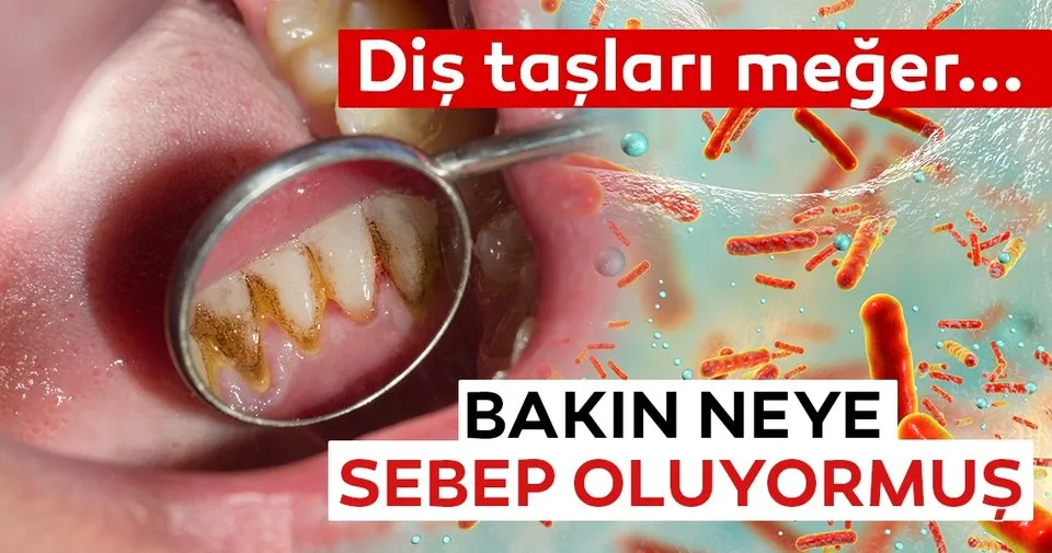 dis tasi dis kaybina neden olabilir