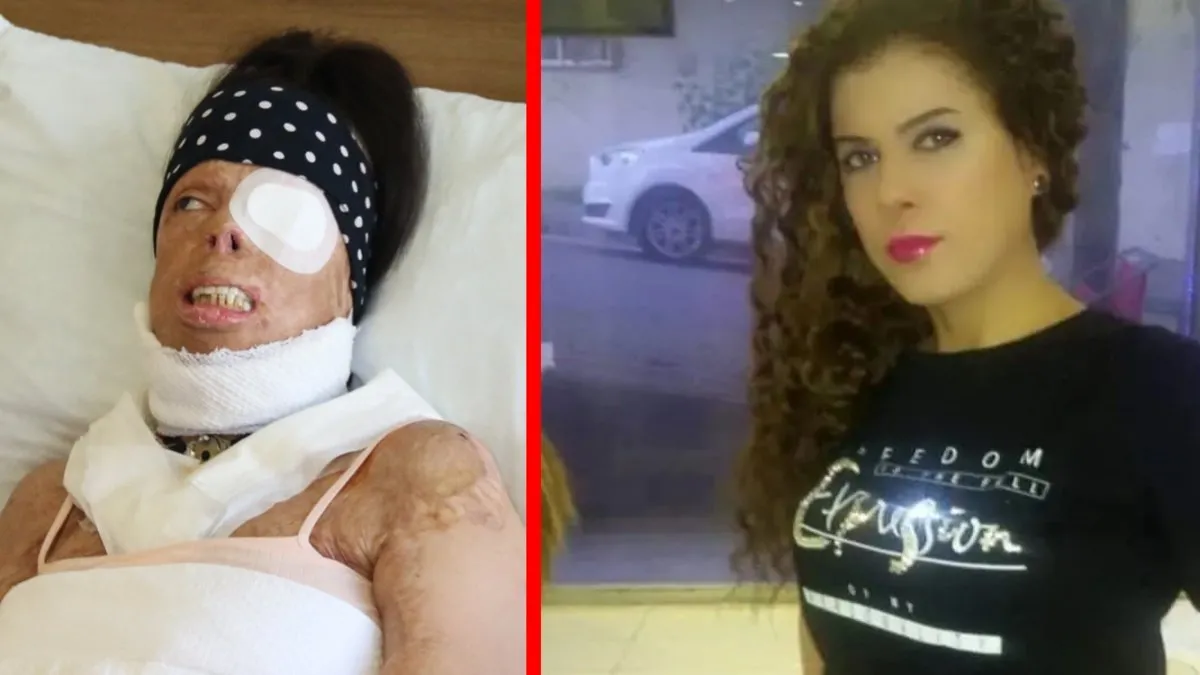 Eski sevgiliden kezzaplı vahşet! Yasemin'in anlattıkları kan dondurdu! Yüzümü yıkamayayım diye suyu kesti