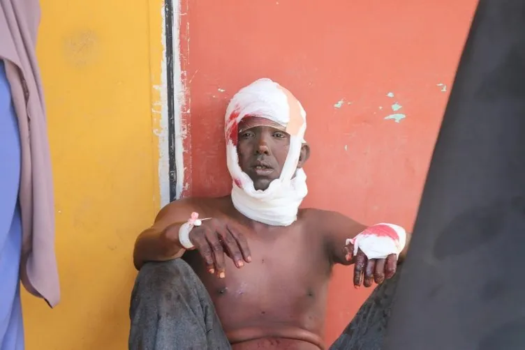 Somali’deki saldırı: Ölü sayısı 76’ya yükseldi