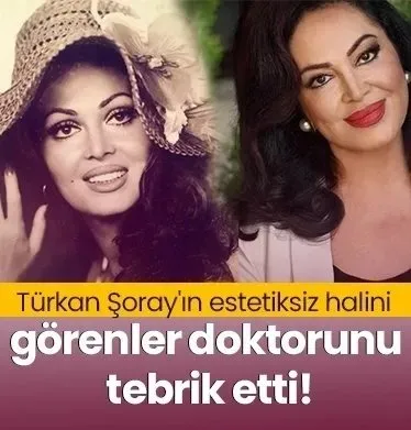 Türkan Şoray’ın estetiksiz halini görenler doktorunu tebrik etti!