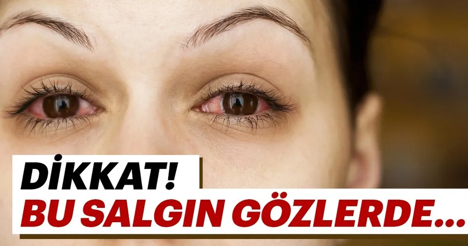 Dikkat Bu Salgin Gozlerde Saglik Haberleri