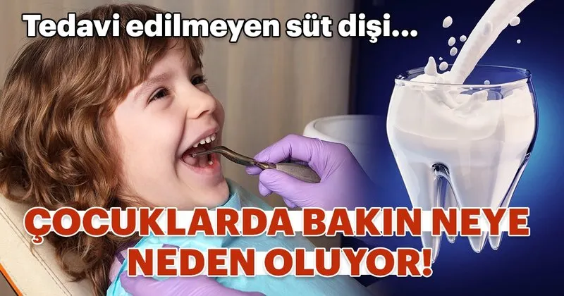 tedavi edilmeyen sut disi cocuklarda bakin neye neden oluyor kadin haberleri
