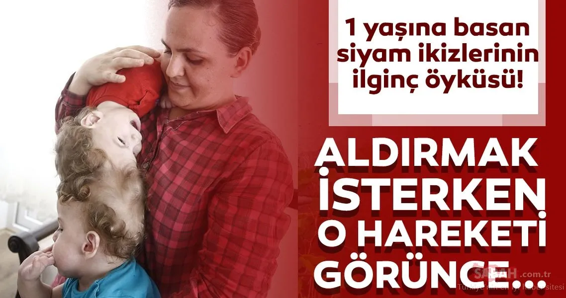 siyam ikizleri bir yasina girdi