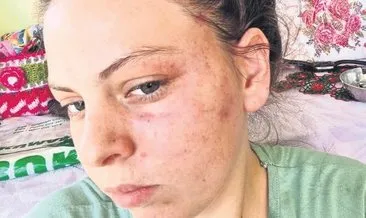 Milli sporcudan eşine şiddet #isparta