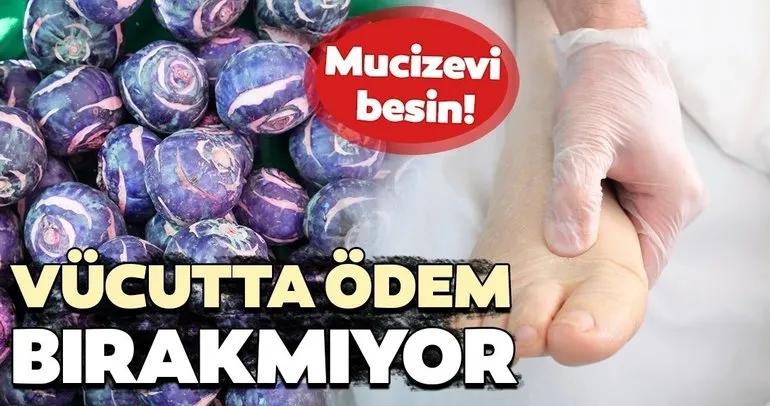 Mucize besinler! Vücutta ödem bırakmıyor