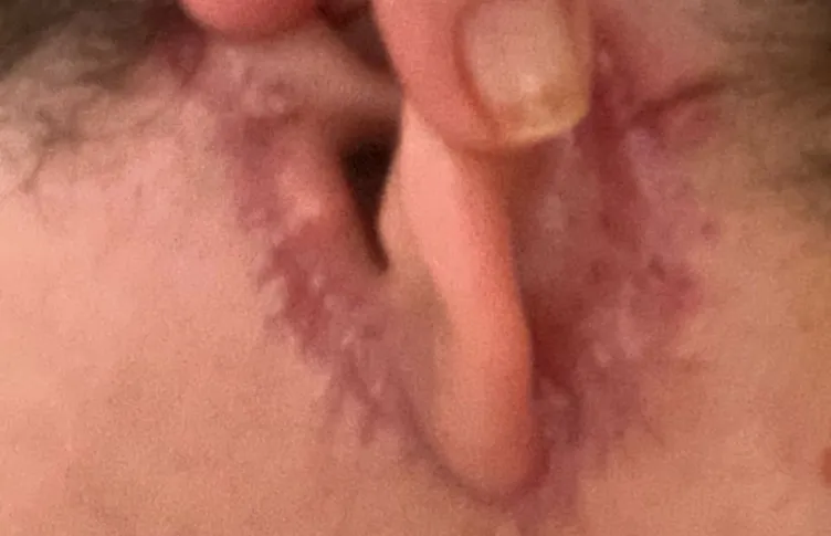 SON DAKİKA | Estetik ameliyatı genç kadının kabusu oldu: Kulağını kesip yüzünü diktiler