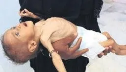 Çocuklar ölüyor ayağa kalk insanlık!