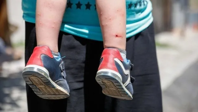 İzmir’de Aedes alarmı! Sivrisinekler şehri istila etti: Tunç Soyer’e tepki yağdı...