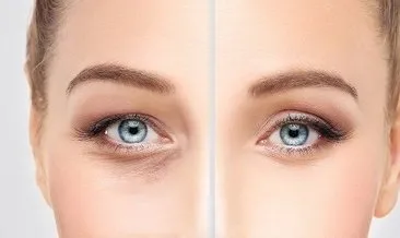 Göz çevresi nasıl daha genç görünür? Göz çevresinin genç göstermenin püf noktaları