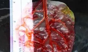 Ispanaktan kalp dokusu üretidi!