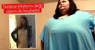 Kilolarıyla birlikte aşkını da kaybetti! 181 kilo verdi kocası tarafından terk edildi…