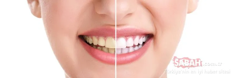 Dişin doğal rengini neler belirliyor?