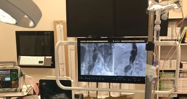 Fethi Sekin Şehir Hastanesi’nde başarılı operasyon