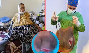 Gün geçtikçe büyüdü! Doktorlar bile gözlerine inanamadı: Karnından tam 40 kilo çıktı!