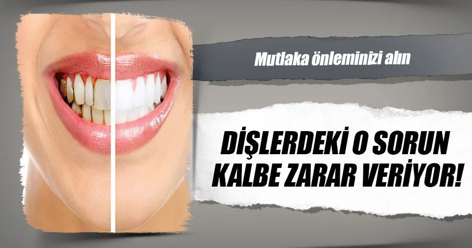 Dislerdeki O Sorun Kalbe Zarar Veriyor Sayfa 7 Saglik Haberleri