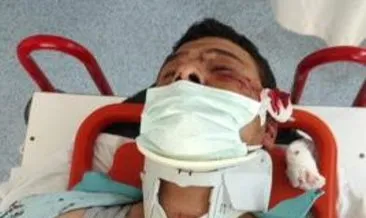 Gazeteci Mustafa Uslu’ya saldırıyı kınadılar: “Bir gazeteciye saldırmak barbarlıktır”