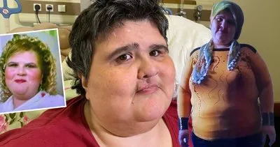 Zayıflamak için internetten ilaç alan kadın 350 kiloya çıktı! Felç kaldı kocası başka kadına kaçtı!