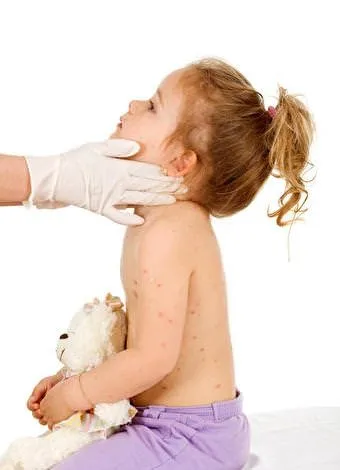Çocukları alerjiden koruyan tavsiyeler