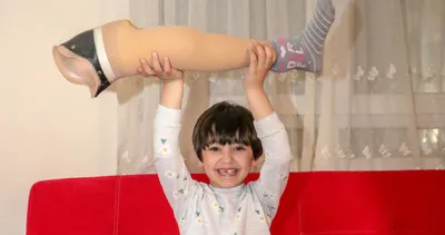 Özge Yıldırım’a yeni protez yollandı! Yüzünde gülücükler açtı!