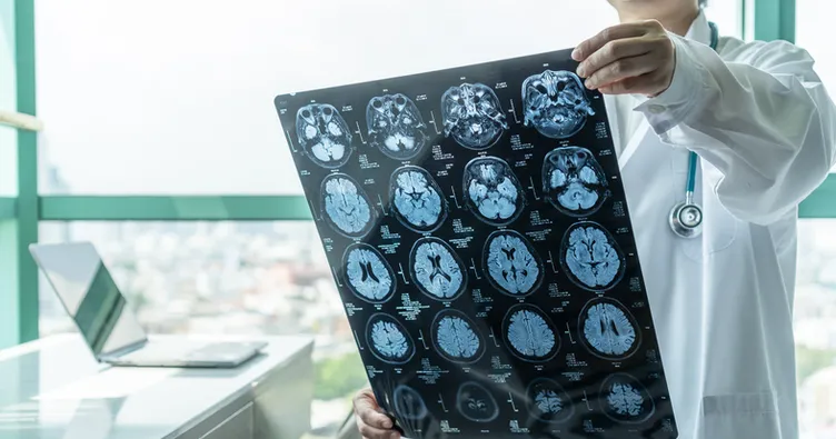 Beyni zinde tutacak gıdalar