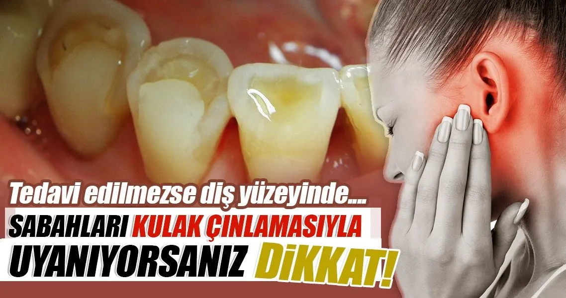 tedavi edilmezse dis yuzeyinde