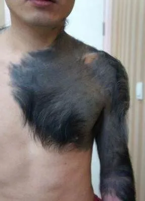 Herkes ona şempanze diyor