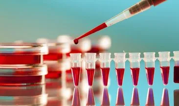 Son Dakika | Kan grubuna göre koronavirüs araştırmasından sonra yeni bulgu: İkizlerde covid belirtileri...
