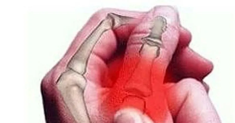 romatizma belirtileri nelerdir