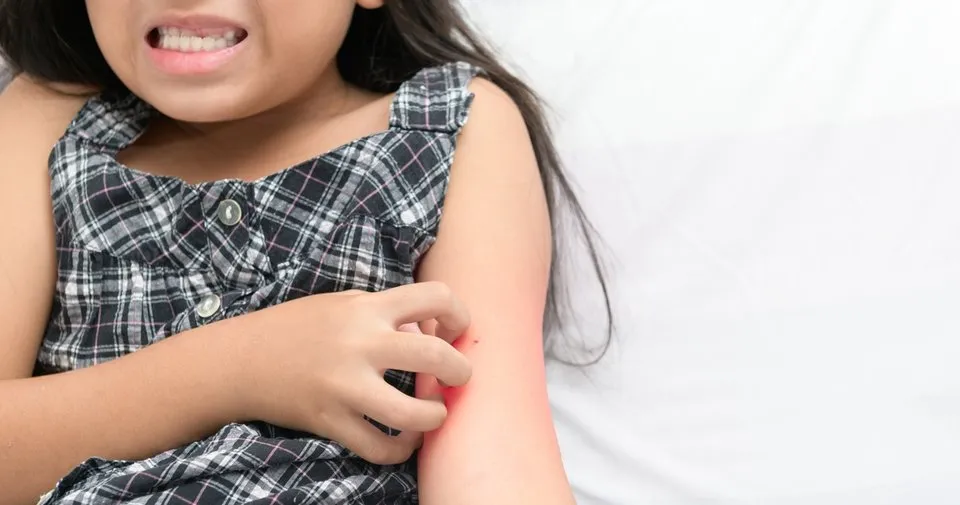 Cocuklara Sik Banyo Yaptirmada Egzama Riski Cocuk Haberleri