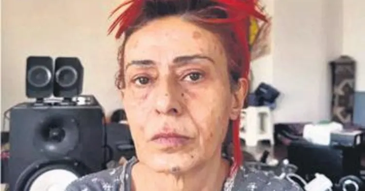 ‘Boya kötüymüş, başka kadınlar da yanmış’